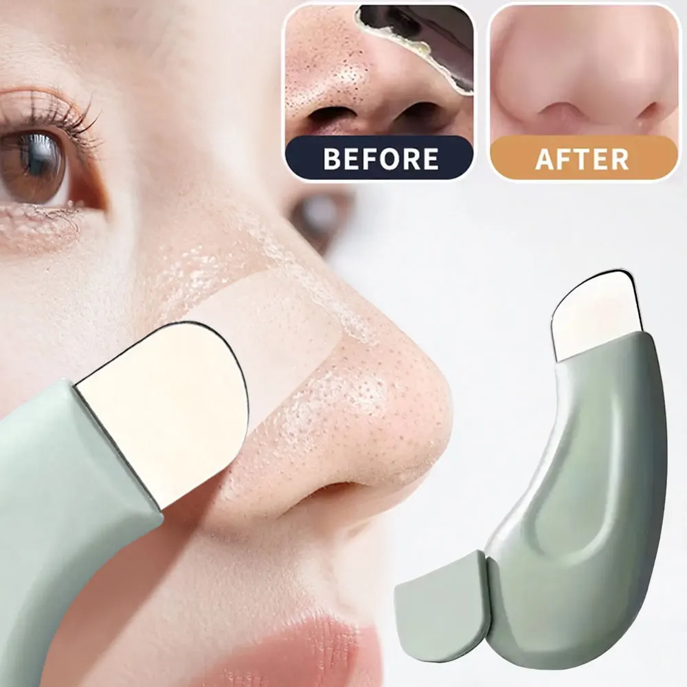 Nasal Aspirator - อุปกรณ์กำจัดสิวเสี้ยนบนใบหน้า, ที่ขูดสิวเสี้ยนแบบล้ำลึก, อุปกรณ์กำจัดสิวหัวขาวบริเวณจมูก, อุปกรณ์ทำความสะอาดรูขุมขนบนผิวหน้า สำหรับดูแลผิวและเสริมความงาม